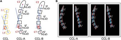 Sagittal balance parameters measurement on cervical spine MR images based on superpixel segmentation